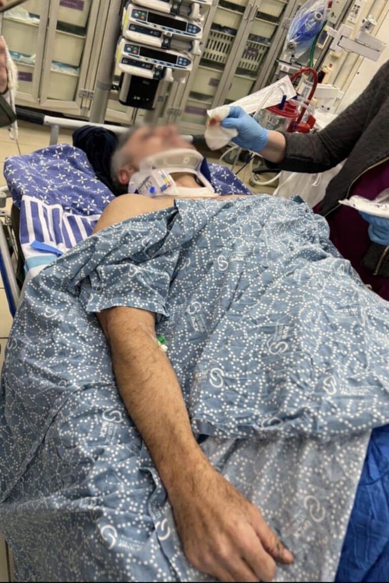אירוע אלימות התרחש ברמת גן: רוכב אופניים הותקף בזמן שרכב על מסלול אופניים צמוד לפארק לאומי
